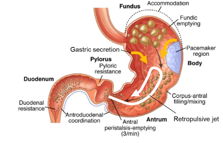 eStomach – A Data-Driven Multiphysics In-Silico Model of the Human Stomach for Application to Bariatric Surgery